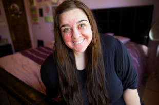 Leah Hope Photography | I am not my skin
